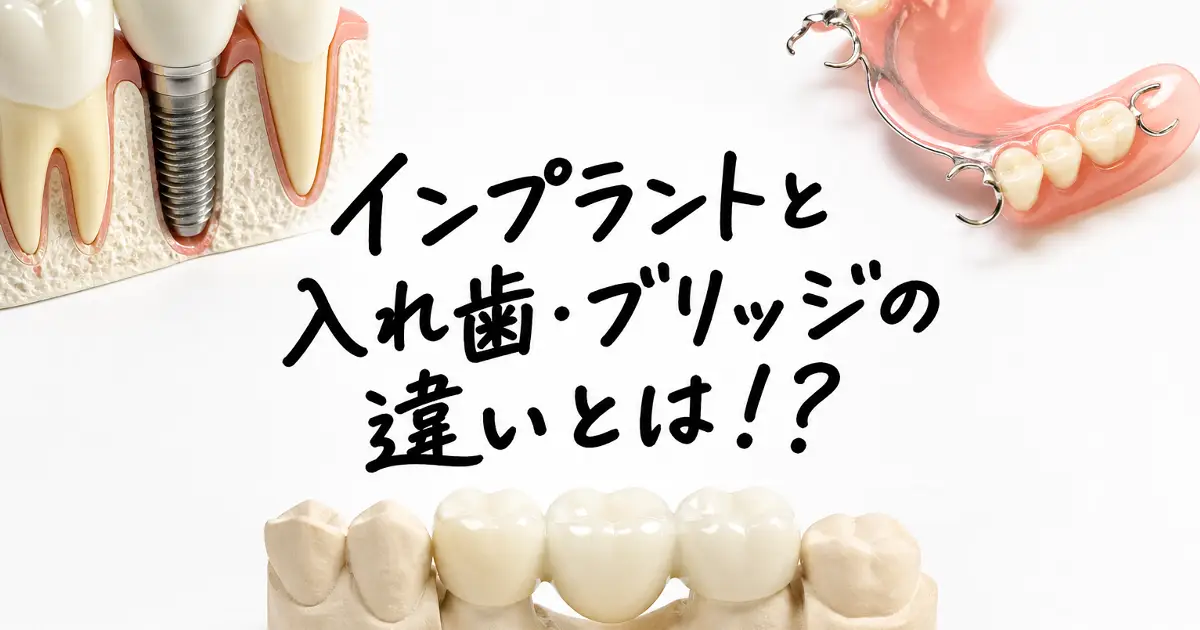 インプラントと入れ歯・ブリッジの違いを比較する歯科治療のイメージ画像